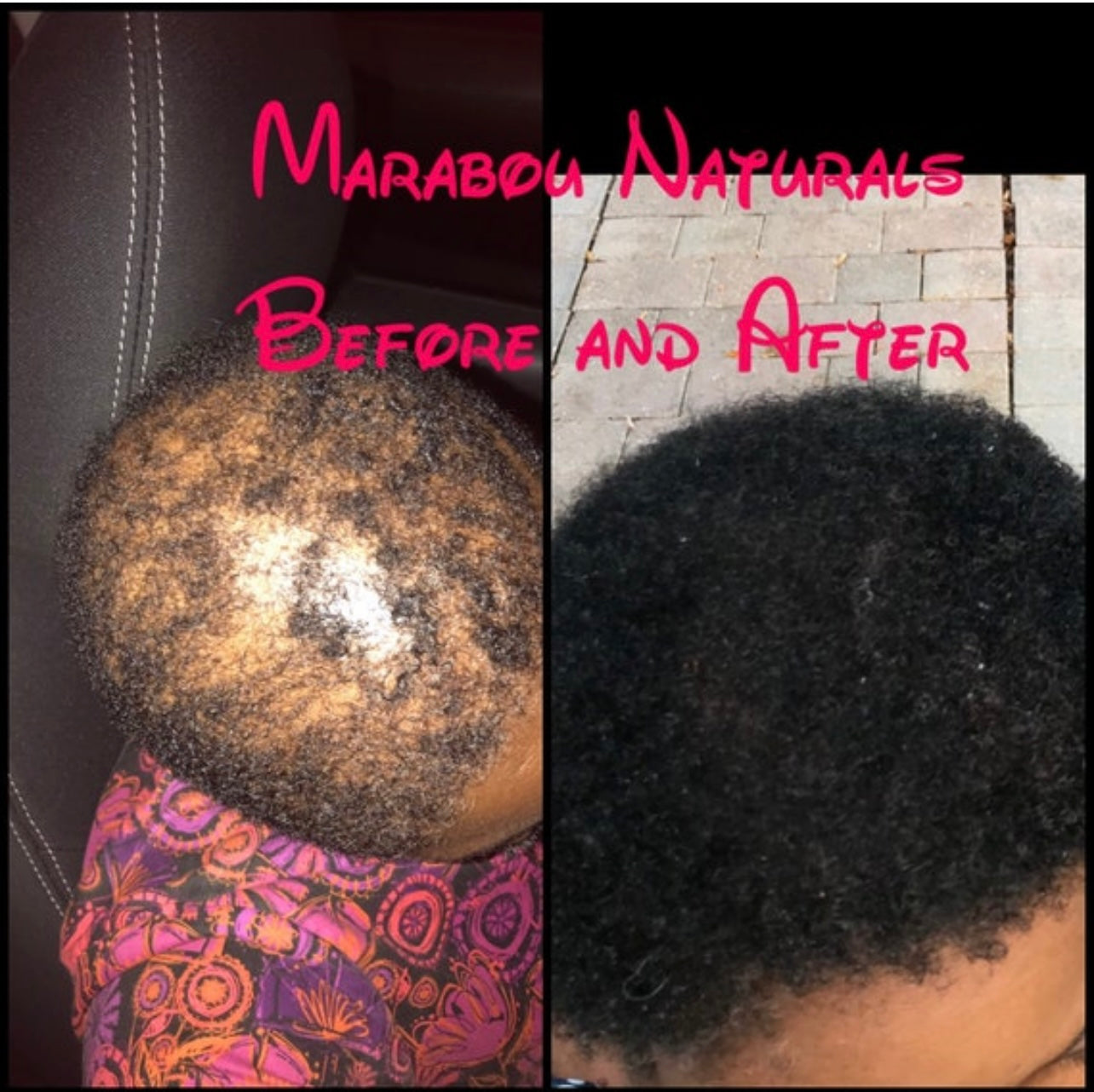 Hair Growth Butter