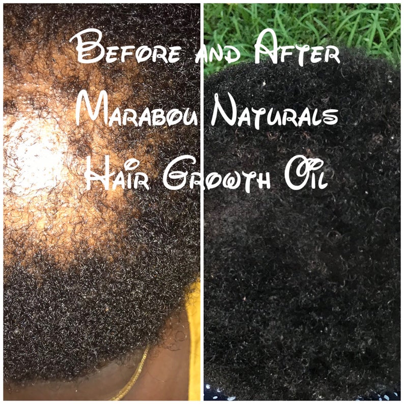 Hair Growth Oil - Marabounaturals