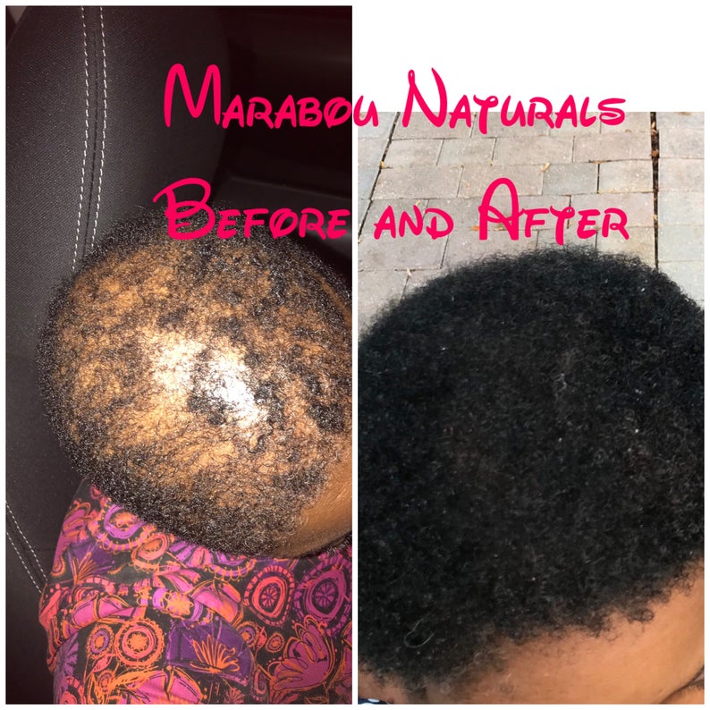 Moisturizing Hair Growth Shampoo - Marabounaturals